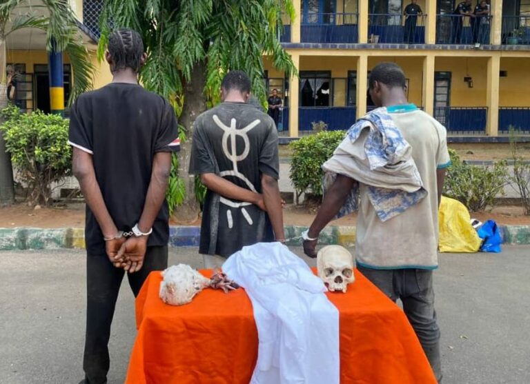 Police Nab Three For Being In Possession Of Human Skull